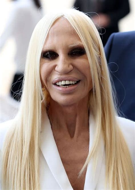 la storia di donatella versace|what happened to donatella versace's face.